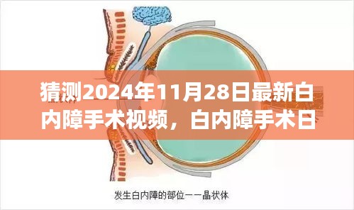 白內(nèi)障手術(shù)最新進(jìn)展揭秘，溫馨之旅中的小驚喜，白內(nèi)障手術(shù)日精彩瞬間回顧（附最新視頻）