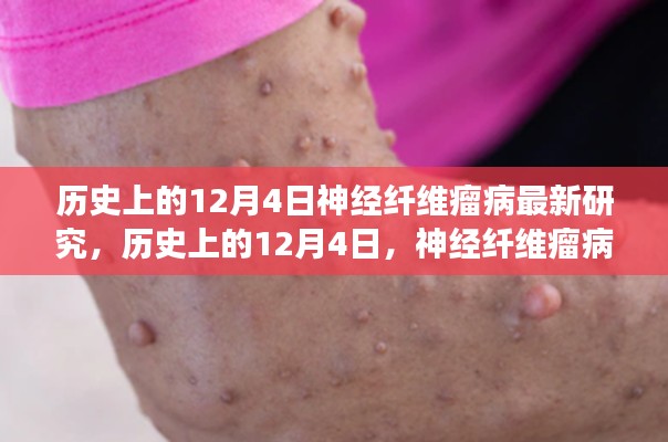 歷史上的神經(jīng)纖維瘤病研究之旅，與自然美景共舞，探尋內(nèi)心寧?kù)o港灣的新突破