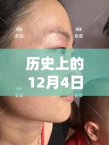 革命性雀斑最新技術(shù)誕生，重塑美顏新紀(jì)元，歷史上的十二月四日里程碑式突破