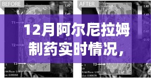阿爾尼拉姆制藥12月實時動態(tài)，生產(chǎn)進展、市場洞察一覽無余