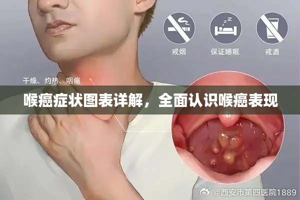 喉癌癥狀圖表詳解，全面認(rèn)識(shí)喉癌表現(xiàn)