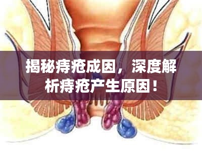 揭秘痔瘡成因，深度解析痔瘡產(chǎn)生原因！