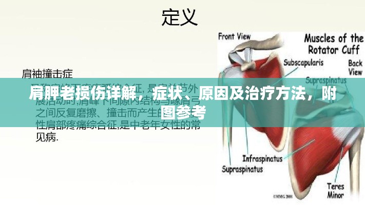 肩胛老損傷詳解，癥狀、原因及治療方法，附圖參考