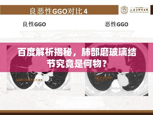 百度解析揭秘，肺部磨玻璃結(jié)節(jié)究竟是何物？