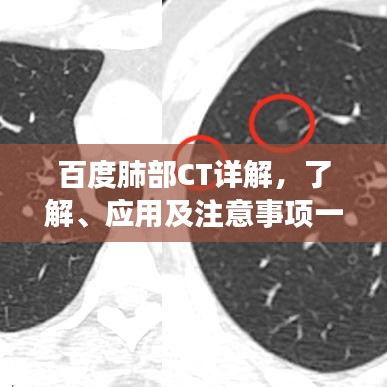 百度肺部CT詳解，了解、應用及注意事項一網(wǎng)打盡