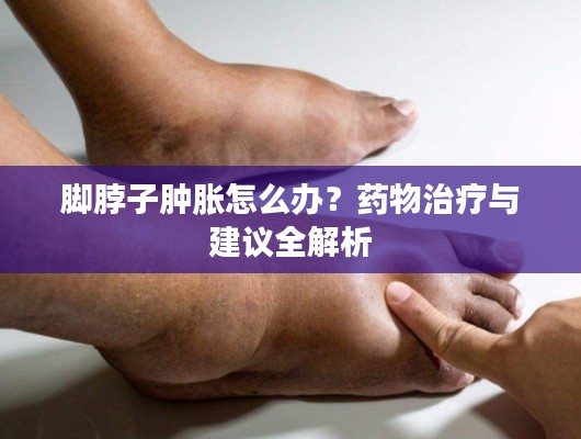 腳脖子腫脹怎么辦？藥物治療與建議全解析