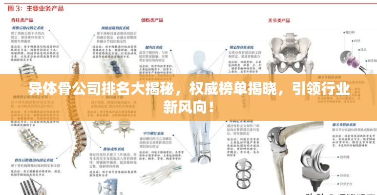 異體骨公司排名大揭秘，權(quán)威榜單揭曉，引領(lǐng)行業(yè)新風(fēng)向！